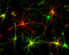 Monoclonal Antibodies made in mouse